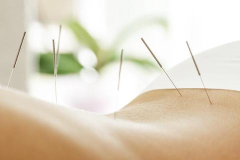 Acupuncture hristelle Metivet Mantes la Jolie Septeuil Yvelines